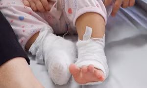 Người lớn bất cẩn, con trẻ bỏng nặng