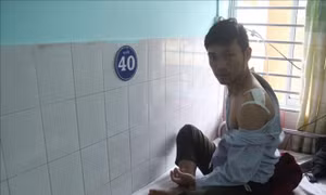 Đã lạng lách, đánh võng, còn hung hãn chém bị thương 4 cảnh sát giao thông
