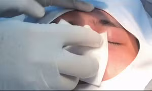 TP Hồ Chí Minh: Một phụ nữ bị mù mắt sau khi tiêm chất làm đầy nâng mũi