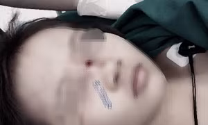  Bố mẹ tất bật ngày Tết, cẩn trọng với những tai nạn sinh hoạt với trẻ nhỏ 