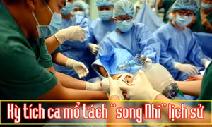 Kỳ tích ca mổ tách 'song Nhi' lịch sử