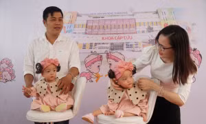 Cặp song sinh Trúc Nhi - Diệu Nhi xuất viện sau 3 tháng được tách rời