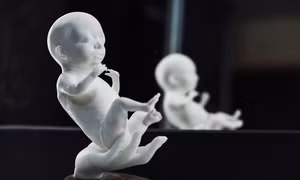 Startup: Mốt tạo hình 3D 'thiên thần' trong bụng mẹ