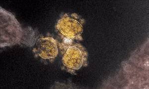 Người nhiễm biến thể Delta có tải lượng virus cao gấp 300 lần so với nhiễm virus SARS-CoV-2 gốc