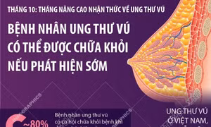 Bệnh nhân ung thư vú có thể được chữa khỏi nếu phát hiện sớm