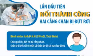 Lần đầu tiên nối thành công hai cẳng chân bị đứt rời