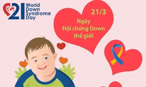 Giúp trẻ bị hội chứng down hòa nhập cộng đồng