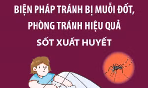Biện pháp tránh bị muỗi đốt, phòng tránh hiệu quả sốt xuất huyết