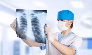 Tìm ra loại thuốc mới rút ngắn thời gian điều trị bệnh lao kháng thuốc