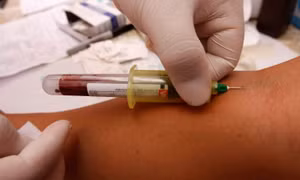 Quốc đảo Fiji phát hiện trường hợp nhỏ tuổi nhất nhiễm HIV