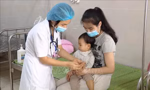 Bác sĩ khuyến cáo 3 biện pháp để phòng bệnh tay chân miệng cho trẻ