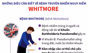 Bệnh truyền nhiễm nguy hiểm Whitmore: Những điều cần biết