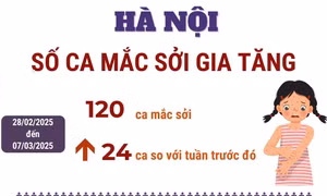 Số ca mắc sởi tại Hà Nội gia tăng