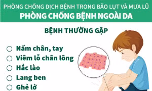 Phòng chống bệnh ngoài da trong mùa bão lụt và mưa lũ