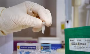 Những thành quả khoa học giúp Việt Nam chủ động đối phó với COVID-19