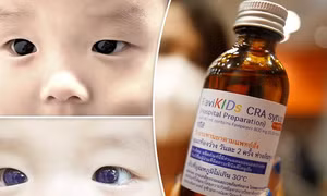 Mắt bé sơ sinh chuyển màu xanh sau khi dùng thuốc điều trị COVID-19
