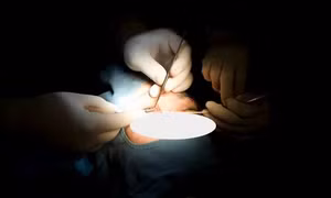 Đại sứ quán Trung Quốc cảnh báo về rủi ro phẫu thuật thẩm mỹ tại Hàn Quốc