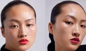 Câu chuyện người mẫu mặt tàn nhang và tiêu chuẩn về cái đẹp ở Trung Quốc