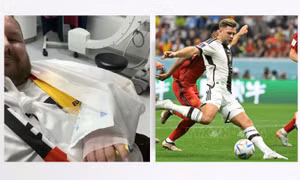 Cổ động viên gãy tay do trúng cú sút của cầu thủ Đức tại EURO 2024