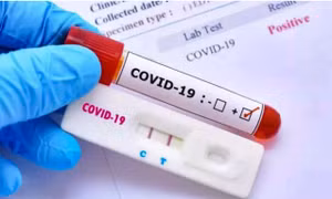 Siết chặt quản lý kinh doanh kít test nhanh COVID-19