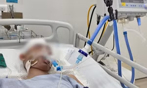 Một học sinh lớp lớp 8 ở Hà Nội bị đánh đến chết não