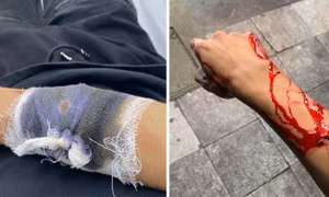 Hà Nội: Nhóm thanh niên dùng dao chém người, cướp xe máy