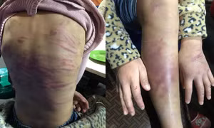 Chỉ đạo xác minh, xử lý vụ bạo hành trẻ em tại quận Hà Đông