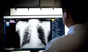 Ứng dụng DrAid™ CT Ung thư gan sử dụng trí tuệ nhân tạo hỗ trợ bác sĩ trong điều trị bệnh