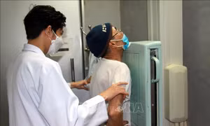 Cả nước phát hiện mới trên 78.500 bệnh nhân lao