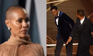 Bệnh rụng tóc mà vợ Will Smith mắc đáng sợ thế nào với hàng triệu người Mỹ