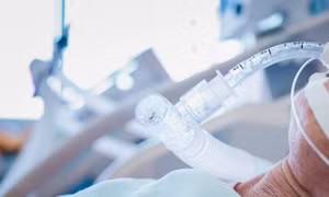Lo ngại máy thở bị lạm dụng, góp phần gây tỉ lệ tử vong cao