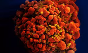 Vaccine mới tiêu diệt HIV ở khỉ, mở ra hy vọng chấm dứt đại dịch AIDS