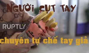 Bị cụt hai tay, vẫn tự chế tay giả giúp 25 triệu người khuyết tật