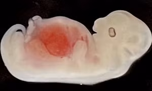 Tạo ra bộ phận cơ thể người đầu tiên trên thân động vật: Triển vọng và tranh cãi