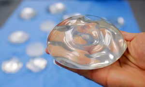 FDA Mỹ ra cảnh báo mạnh mẽ về phẫu thuật nâng ngực
