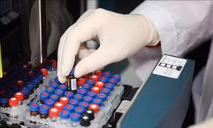 Phương pháp điều trị tiên tiến mang lại hy vọng chấm dứt AIDS vào năm 2030