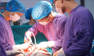 Phẫu thuật thành công ca u xơ tử cung khổng lồ nặng 4kg