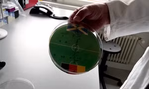 Dùng vi khuẩn E.coli để dự đoán kết quả trận đấu EURO 2024