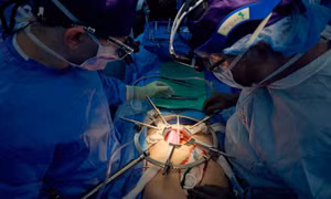 Người phụ nữ Mỹ phá kỷ lục sống lâu sau ghép nội tạng lợn chỉnh sửa gene