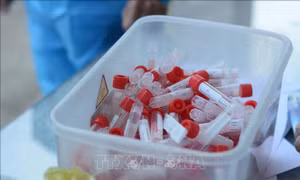Thông tin có 14 ca dương tính tại Bệnh viện Đa khoa tỉnh Thái Bình là sai sự thật