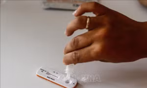Người dân Pháp tăng cường tích trữ bộ xét nghiệm COVID-19