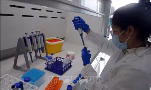 Cấp bách có hướng dẫn việc kiểm tra thực phẩm nhập khẩu