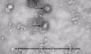 Bổ sung bệnh viêm đường hô hấp cấp do virus Corona vào danh mục các bệnh truyền nhiễm nhóm A