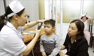 Chuyên gia y tế hướng dẫn cách phòng bệnh về mắt trong mùa hè