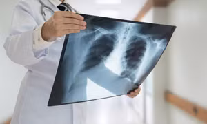 Chế tạo thiết bị dò tia X mỏng nhất thế giới