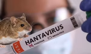 Pháp ghi nhận ca nhiễm mới virus Hanta chủng Andes