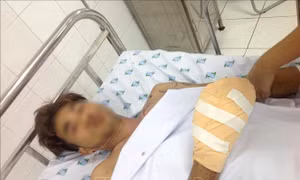 Vừa nạp pin vừa dùng điện thoại, nam thanh niên phải tháo khớp ngón tay