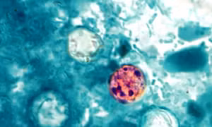 Ký sinh trùng Cyclospora là gì và vì sao đang gây lo ngại tại Mỹ?