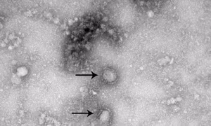 Mỗi người bệnh nhiễm virus corona có thể lây truyền cho 2 đến 3 người