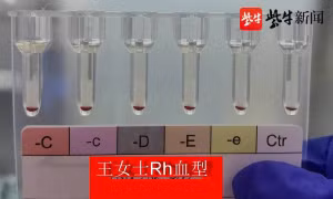 Trung Quốc phát hiện 2 người có ‘nhóm máu vàng' hiếm nhất Trái Đất